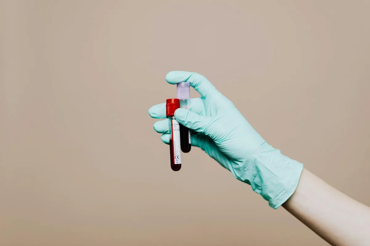 Şanlıurfa'da Hematoloji ve Kan Hastalıkları Uzmanları Rehberi